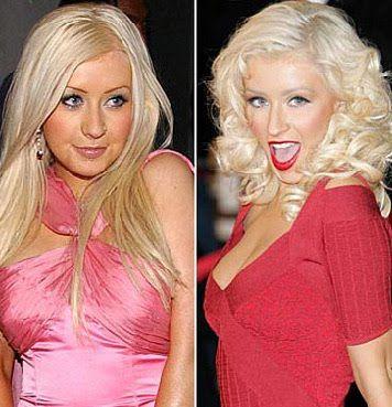 Пластические операции звезд: до и после