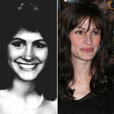 Пластические операции звезд: до и после