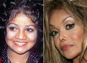 Пластические операции звезд: до и после