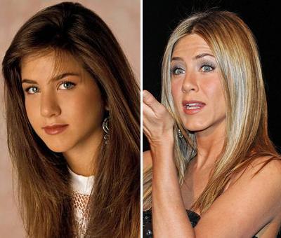 Пластические операции звезд: до и после