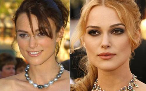 Пластические операции звезд: до и после