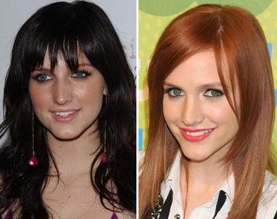 Пластические операции звезд: до и после