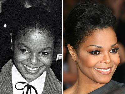 Пластические операции звезд: до и после