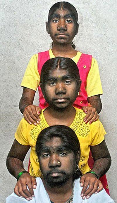 В Индии найдена целая "семья оборотней"