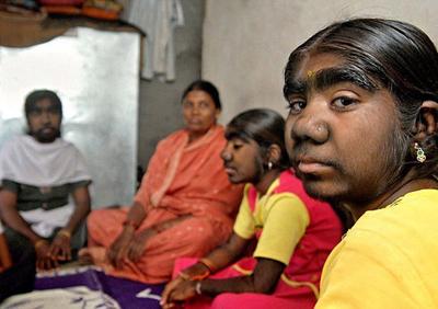 В Индии найдена целая "семья оборотней"