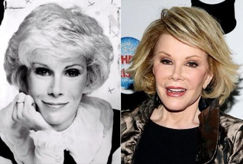 Звезды, перестаравшиеся с пластикой и  ботоксом: до и после