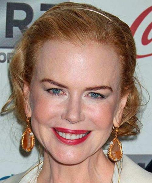 Звезды, перестаравшиеся с пластикой и  ботоксом: до и после