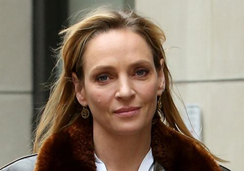 Звезды, перестаравшиеся с пластикой и  ботоксом: до и после