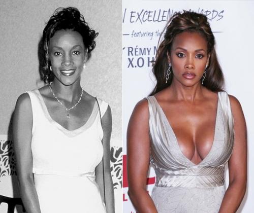 Звезды, перестаравшиеся с пластикой и  ботоксом: до и после