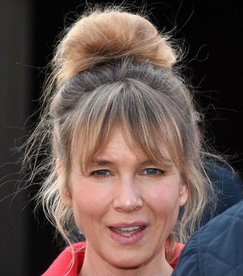 Звезды, перестаравшиеся с пластикой и  ботоксом: до и после