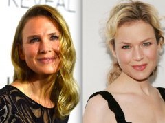 Звезды, перестаравшиеся с пластикой и  ботоксом: до и после