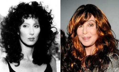 Звезды, перестаравшиеся с пластикой и  ботоксом: до и после