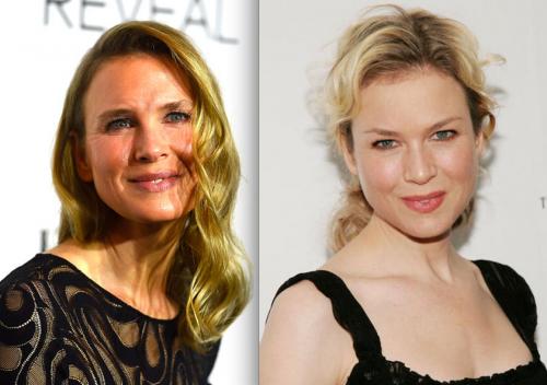 Звезды, перестаравшиеся с пластикой и  ботоксом: до и после