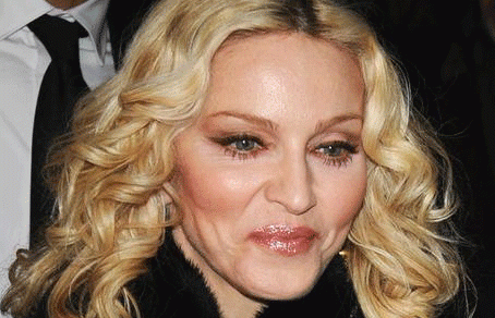 Звезды, перестаравшиеся с пластикой и  ботоксом: до и после