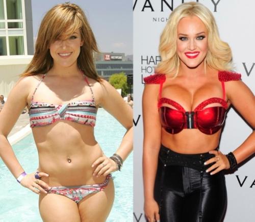 Звезды, перестаравшиеся с пластикой и  ботоксом: до и после