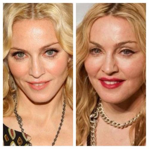 Звезды, перестаравшиеся с пластикой и  ботоксом: до и после