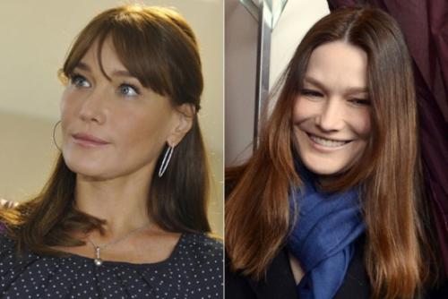 Звезды, перестаравшиеся с пластикой и  ботоксом: до и после