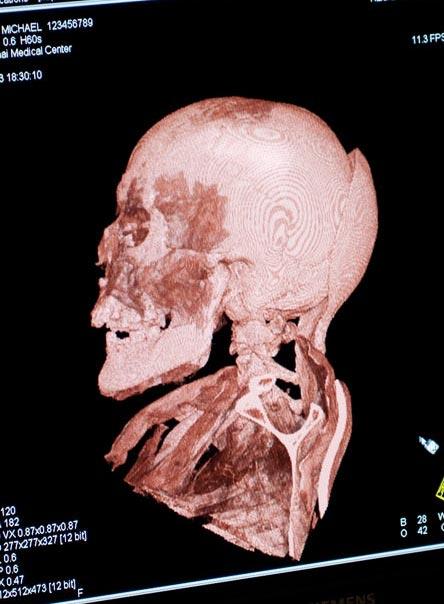 Потревоженные мертвецы путешествуют по миру