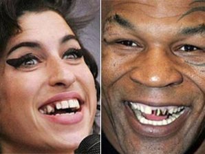 Самые неприятные улыбки знаменитостей