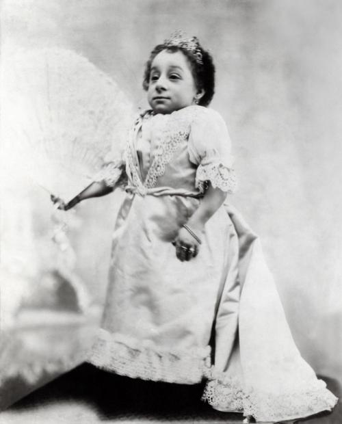 Самые известные лилипуты в истории