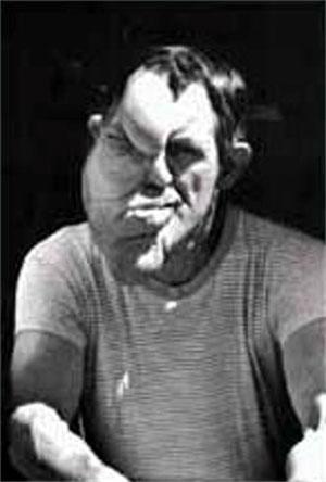 Насмешка природы: двуликие Янусы