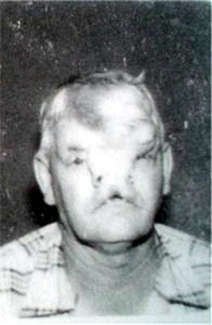 Насмешка природы: двуликие Янусы