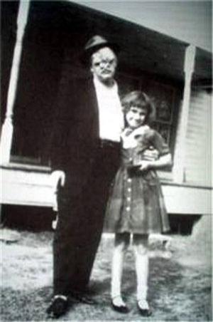 Насмешка природы: двуликие Янусы