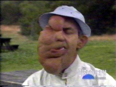 Насмешка природы: двуликие Янусы