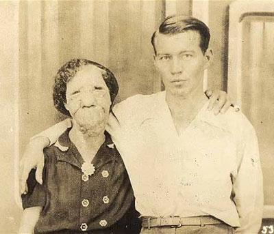 Насмешка природы: двуликие Янусы