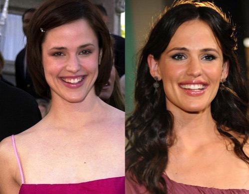 Как звёзды изменились за 10 лет