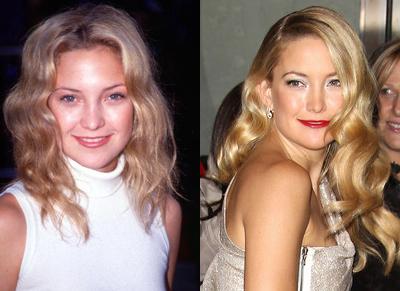 Как звёзды изменились за 10 лет