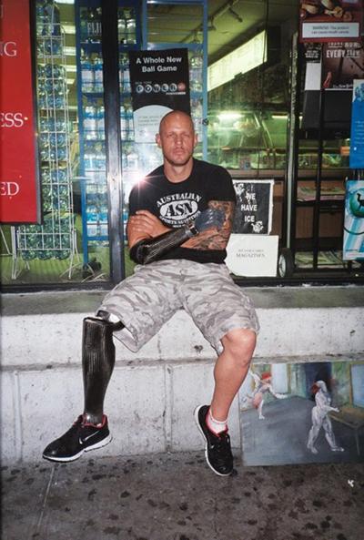 Выжившие после встречи с акулой: реальные фотосвидетельства