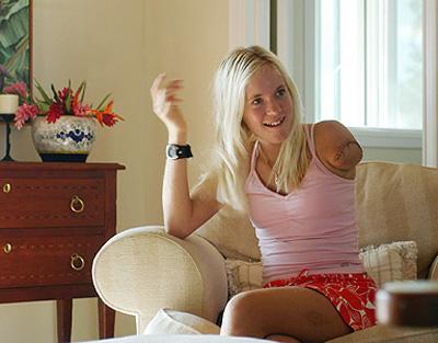 Выжившие после встречи с акулой: реальные фотосвидетельства