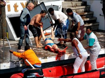 Выжившие после встречи с акулой: реальные фотосвидетельства