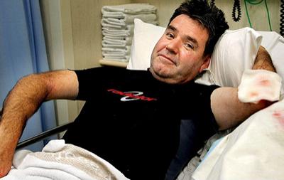 Выжившие после встречи с акулой: реальные фотосвидетельства