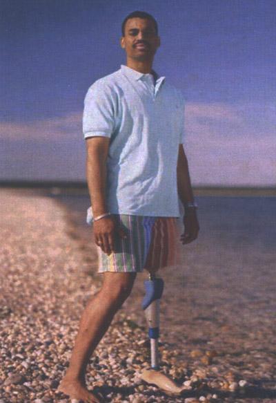 Выжившие после встречи с акулой: реальные фотосвидетельства