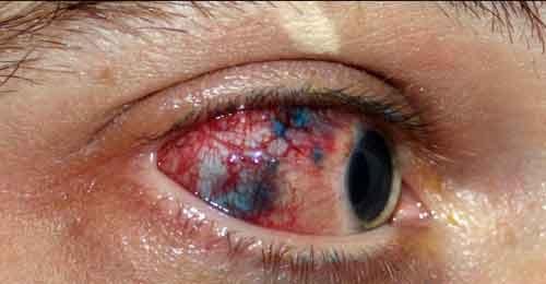 Экстремальный боди-арт: нервных просят удалиться!..