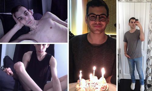 До и после: 20 примеров людей, сумевших побороть анорексию