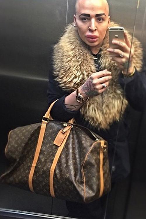 Фанаты, сделавшие пластическую операцию ради сходства с кумиром