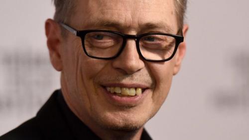 15 звезд с самыми неголливудскими улыбками в мире