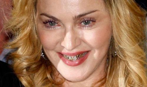 15 звезд с самыми неголливудскими улыбками в мире