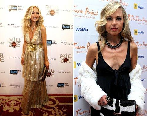 10 звезд, которым не идет худоба