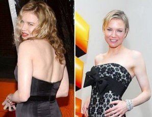 10 звезд, которым не идет худоба