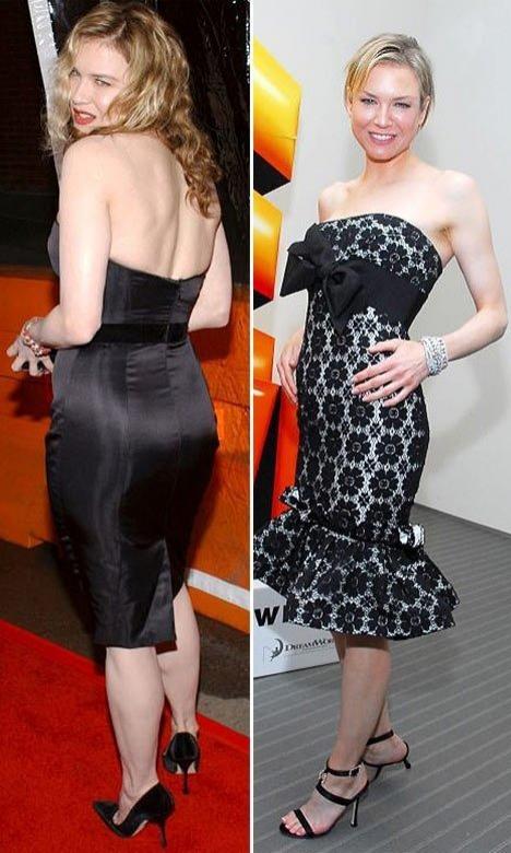 10 звезд, которым не идет худоба