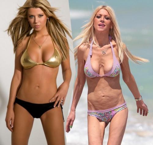 10 звезд, которым не идет худоба