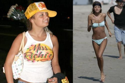 10 звезд, которым не идет худоба