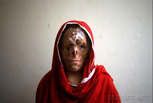 Шок: как на Востоке мужья наказывают своих жен