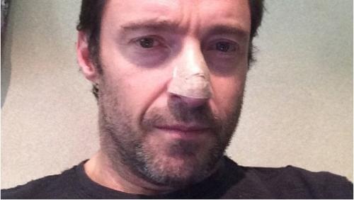 Звезды, которые сумели победить рак