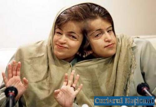 Ошибки природы: люди с редкими заболеваниями