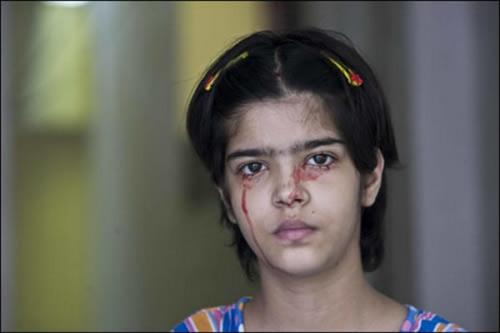 Ошибки природы: люди с редкими заболеваниями